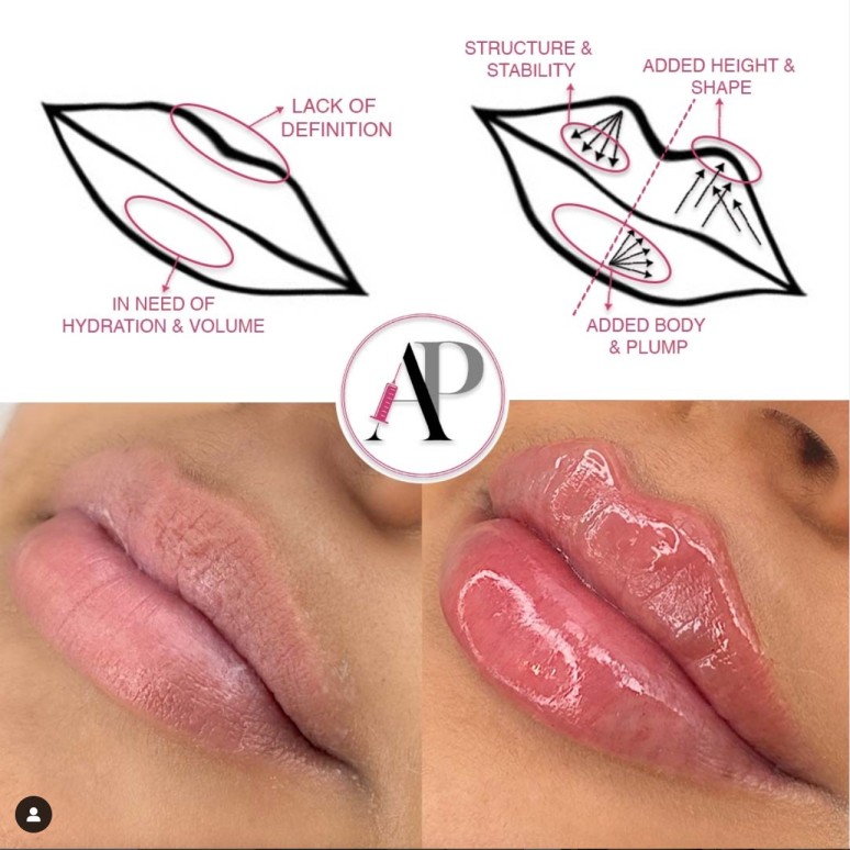 Mastering the Art of Russian Lip Technique